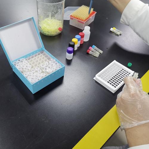 【睿信生物 人25-羟基维生素总d25-vitdelisa试剂盒】价格_批发_厂家_